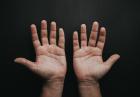 Egzema na dłoniach — poznaj podstawy pielęgnacji