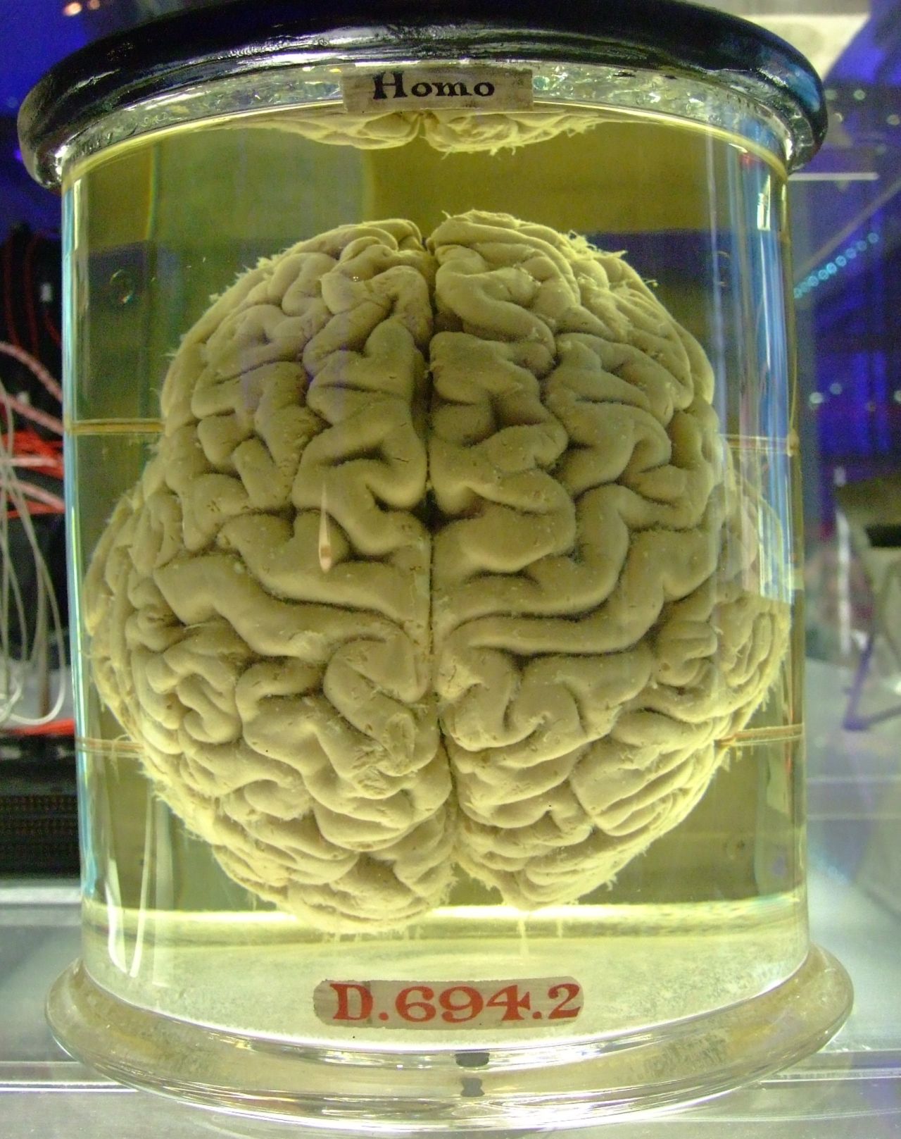 Mózg - nauka i ciekawostki