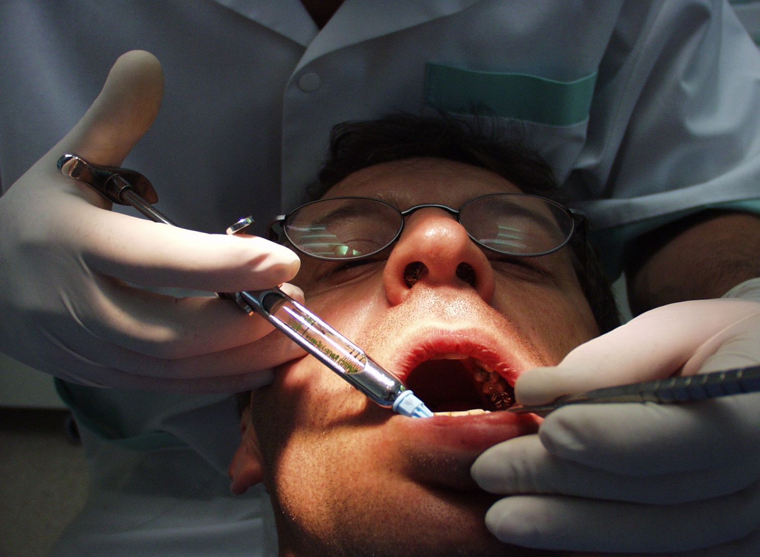 Dentysta wyrwał pacjentce 13 zębów