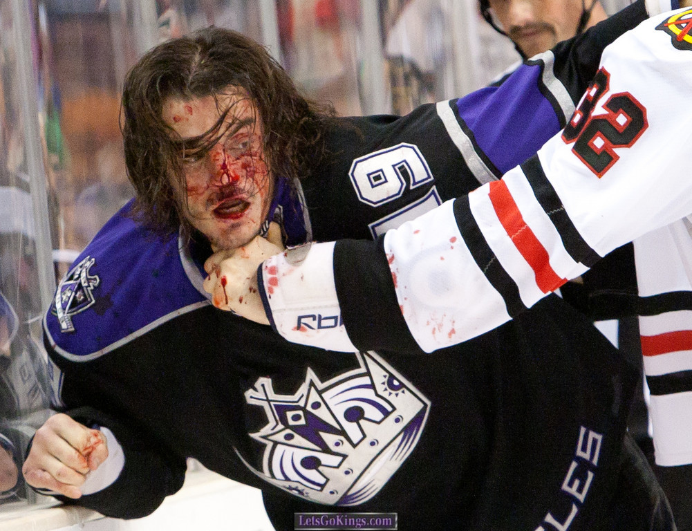 Masakra tygodnia w NHL - starcie John Scott vs. Kevin Westgarth