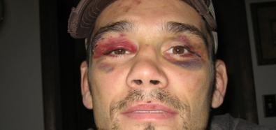 UFC 147: Rich Franklin zastąpi Vitora Belforta