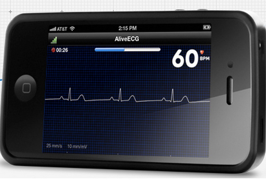 Alivecor Heart Monitor